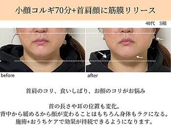 ペルク(perk)/小顔コルギ70分