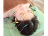 【むくみ・二重顎・たるみ改善】リフトアップ美容鍼（ドライヘッド付き）60分