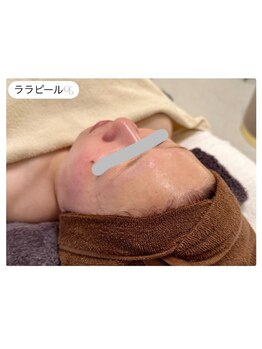 エ リンダ(E- LINDA)/ララピール