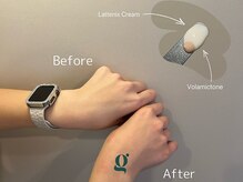 グレイスリリー(grace lily)/