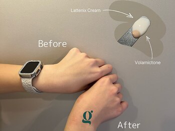 グレイスリリー(grace lily)/