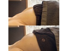 バストアップだけでなく左右差も改善できます。