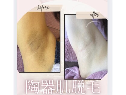 ディオーネ 朝霞台店(Dione)の写真