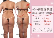 ビューティーワンド ココ(Beauty Wand COCO)