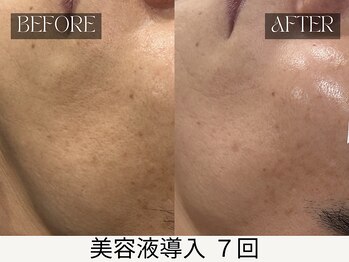 スキンジム(SKIN GYM)/毛穴・くすみレスのツヤ肌へ