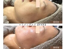 ルームエイトエイティスリー 新宿(R883)/エイジングケア【VAR】