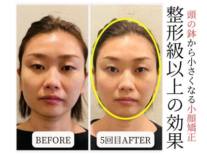 ロシュニの写真
