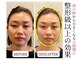 ロシュニの写真
