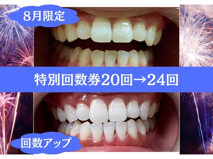 ビーホワイト 名古屋金山店(BE WHITE)の写真