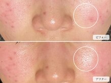 スローガーデン(Slow Garden)/ハーブ　ビフォーアフター