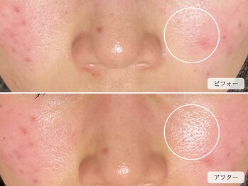 スローガーデン(Slow Garden)/ハーブ ビフォーアフター