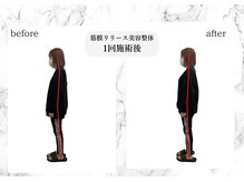 トキ(TOKI)/筋膜リリース美容整体　初回施術