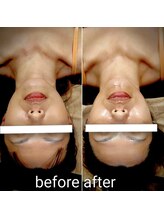 ゾウケイ(ZOKEI)/ハイピールイントゥで引き上げ♪