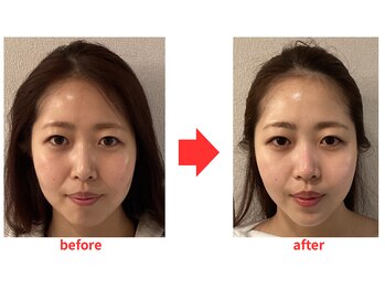 ブプラ 小倉店(BUPURA)/