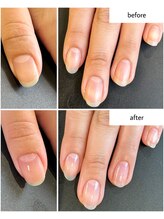 ケアプラス(care plus)/ハンドネイルケア