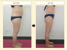 エステアンドトレーニング ビビ(ViVi)/50代　全身エステとトレーニング