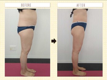 エステアンドトレーニング ビビ(ViVi)/50代　全身エステとトレーニング