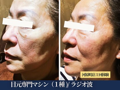 エヴァーグレース 河原町店の写真