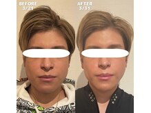 エッセンスビー 六本木/輪郭3点