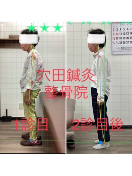 穴田鍼灸整骨院/整体・骨盤・ねこぜ・まき肩矯正