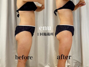 エヌ 白金台(enu)/enu全身エンダモロジー90分