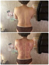 アコルデ(Acorde)/