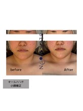 ブルームーン(BLUE MOON)/小顔矯正オールハンドエステ