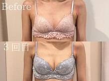 ナリッシュ バスト 六本木(Nouriche Bust)/バストアップ◇ビフォーアフター