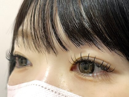 アネラプラス(ANELA Plus+)の写真