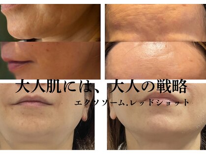 ビューティータワー(Beauty Tower)の写真