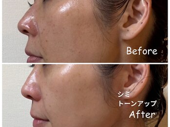 サロンドモモ(SALON de MOMO)の写真/「老け見え」のお悩みに◎肌深部を温熱で活性化し、乳酸ピーリングで、くすみ一層！トーンアップ★