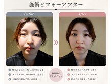 ゲンキー(genkey)の雰囲気(30代女性ハンドセラピー15分のビフォーアフター♪)