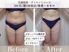 人気No.1【温活】最先端よもぎ蒸し60分+前後リンパマッサージ20分+足湯15分
