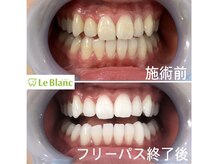 ルブラン 奈良店(Le Blanc)/健康的な白い歯で