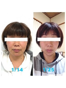 ビューティスタジオＫ/別人級小顔フェイシャル