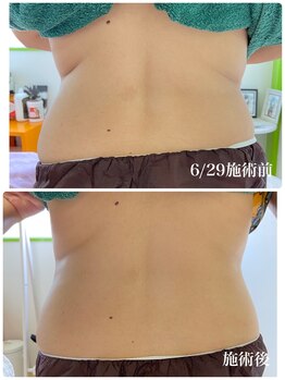 サロンドール(SalonDoll)/