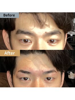 眉毛ハウス 吉祥寺店(眉毛HOUSE)/お客様の施術例(吉祥寺/東京)