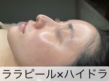 マドモアゼル 麻布十番/ララピール×ハイドラ