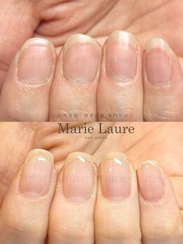 マリーロール 天王寺店(Marie Laure)/自爪育成/深爪矯正/ネイルケア