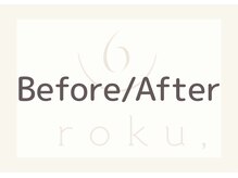 ロク(roku,)/【Before→After】