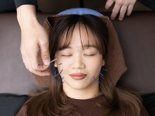 痛みの少ないソフトな施術を心がけます