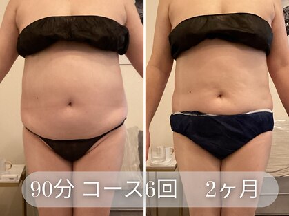 ラシク 吉祥寺(LACHIC)の写真