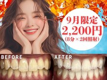 LBSホワイトニング 新宿店