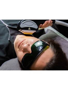 顔脱毛がしたい