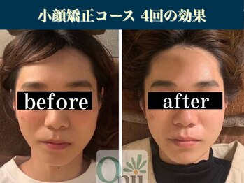 キュープ 表参道店(Qpu)/継続が「小顔」と「美」をつくる