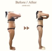 ビループ(biloop)