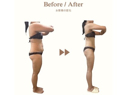 ビループ(biloop)の写真