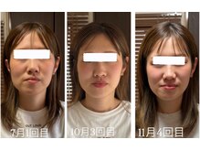 ボーンズ(BONES)の雰囲気（優しく、痛みの少ない小顔矯正です）