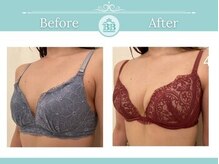 美人バスト 新潟店/ 【バストアップ★育乳】症例