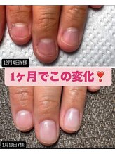 タヌ(TANU)/１か月でここまで変化！！